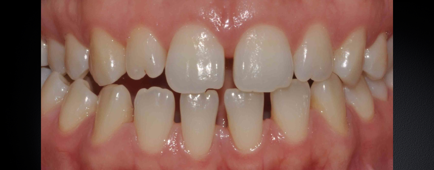 Ortodonzia e Restaurativa estetica